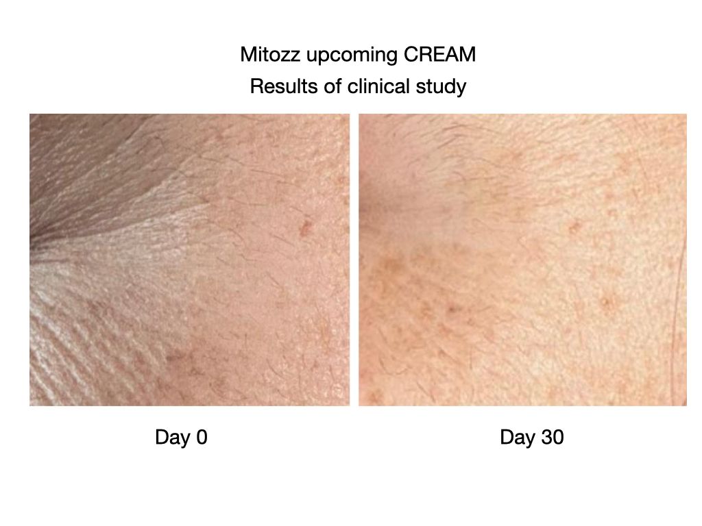 Mitozz RS skin cream results of clinical study