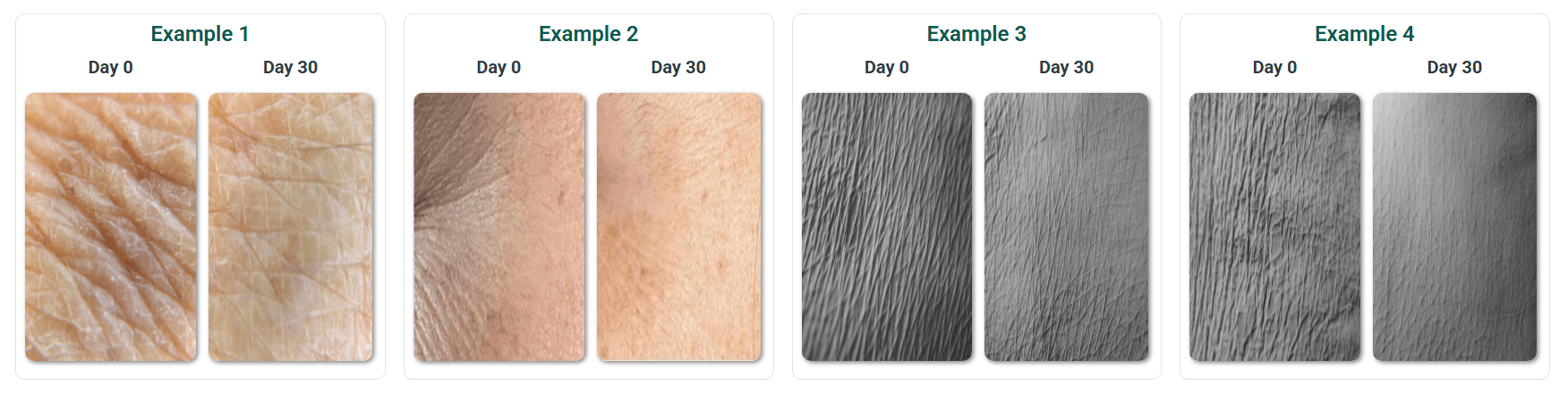 4 Examples of Day 0 to Day 30 Mitozz RS results