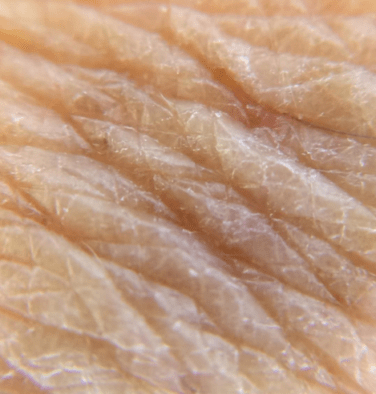 Close-up skin image before the 30-day period, comparison one.