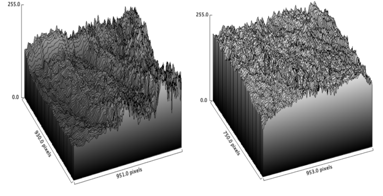 Three-dimensional skin surface maps used to analyze changes in wrinkle height, depth, and roughness.